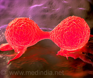 乳腺癌血管可以杀死癌细胞和停止传播