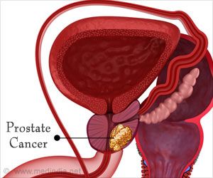评估前列腺癌的风险预测工具