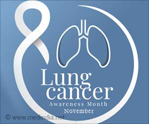 两年:最佳免疫治疗在晚期肺癌的持续时间
