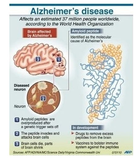 阿尔茨海默病——基因增强记忆力