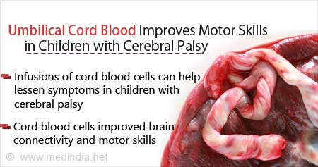 脐带血可提高脑瘫患儿的运动技能